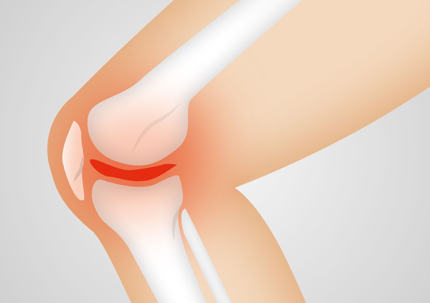 Image Header Tindakan untuk Osteoporosis, Tulang Keropos Orang Tua